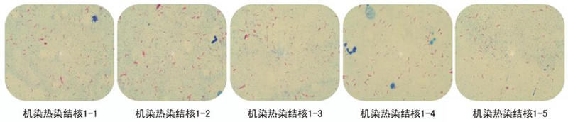 染色結果