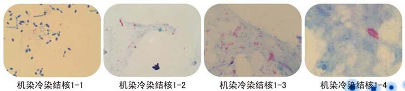 染色結果